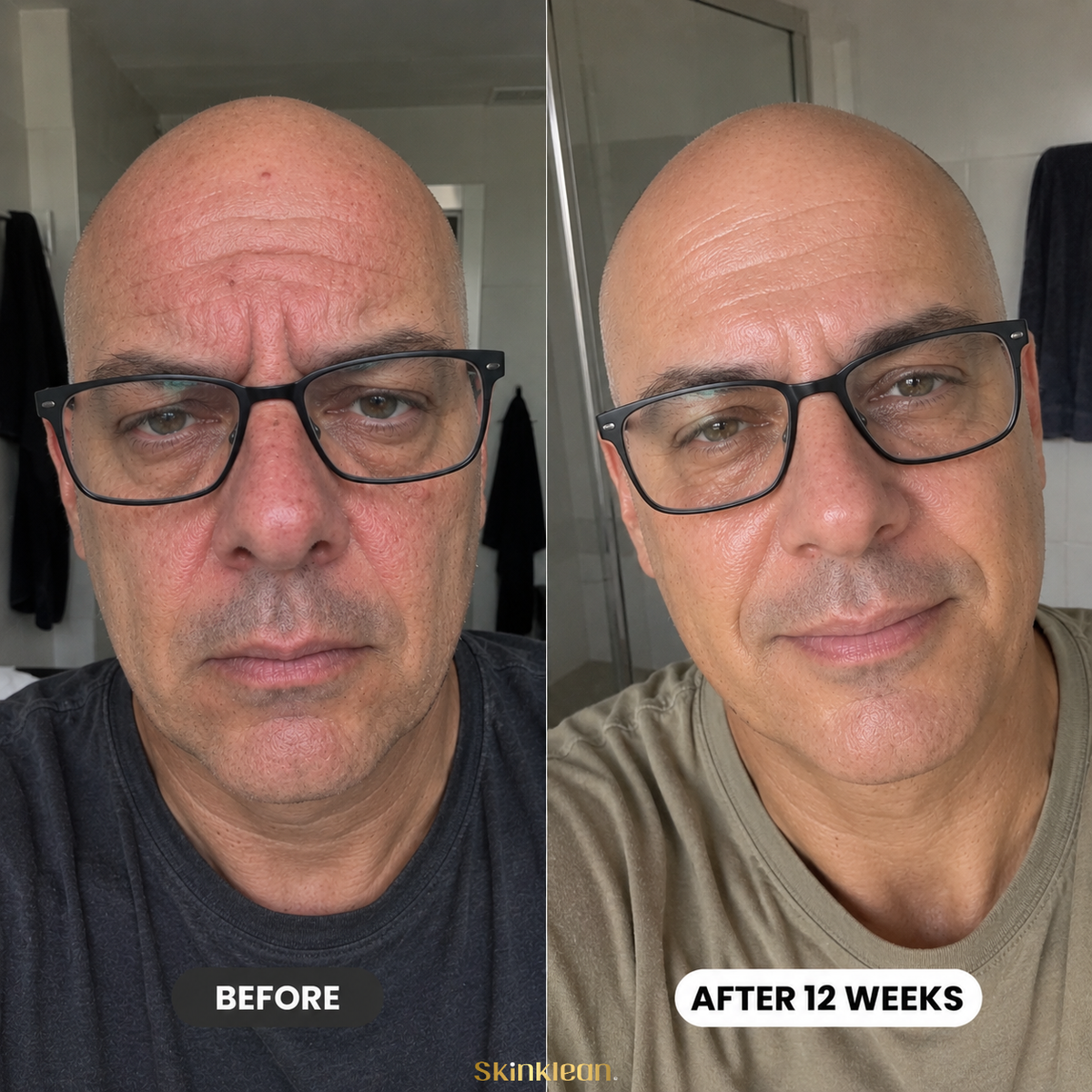 Triple Collagen® Plumping Gel Mask Men