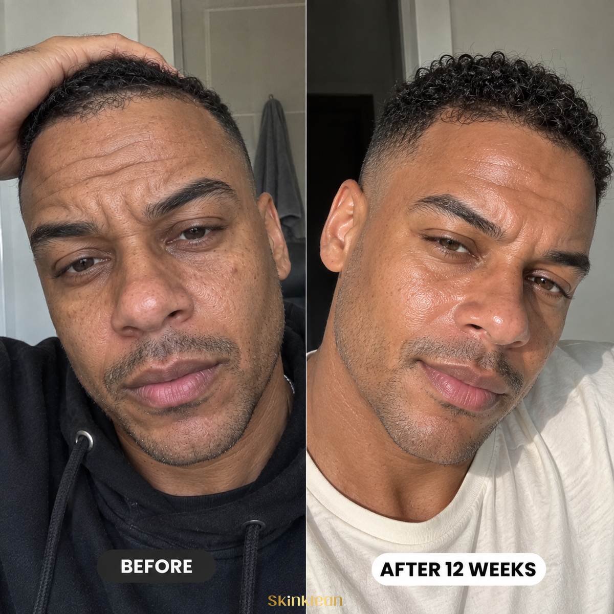 Triple Collagen® Plumping Gel Mask Men