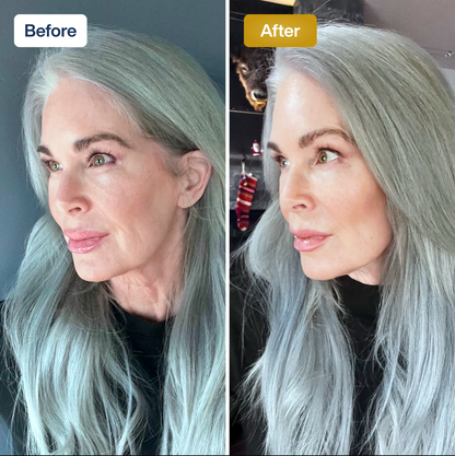 SkinKlean© Collagen Face Mask