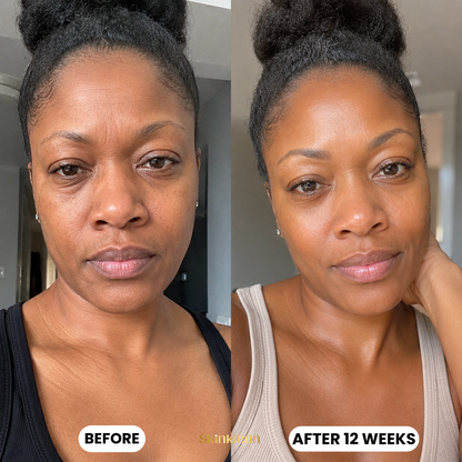 Baby Collagen FACE Mask
